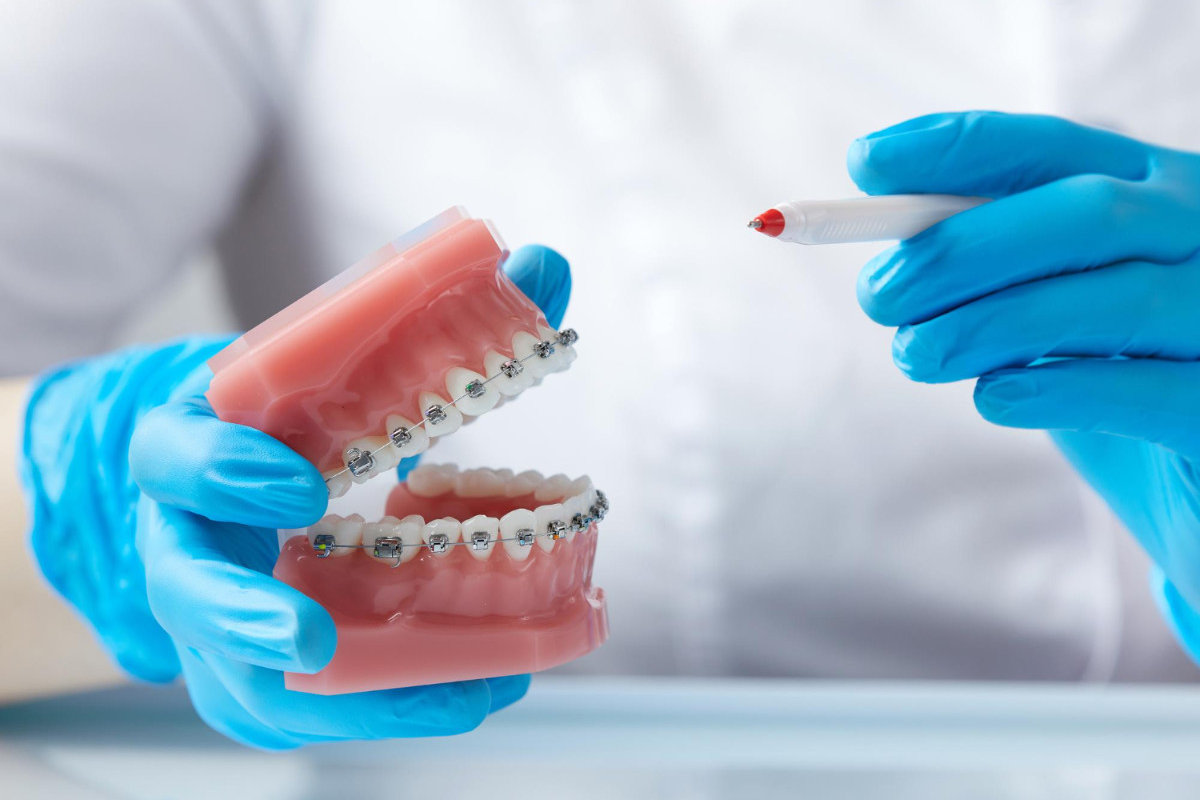 kieferorthopaedische behandlung2 smile tuerkei